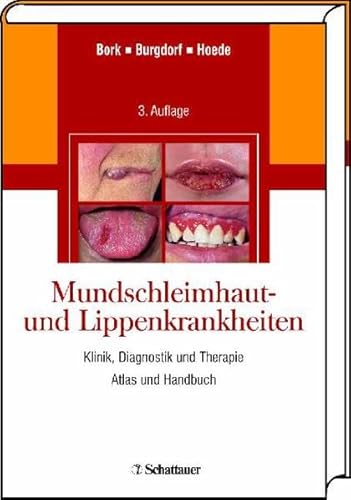 Beispielbild fr Mundschleimhaut- und Lippenkrankheiten: Klinik, Diagnostik und Therapie. Atlas und Handbuch [Gebundene Ausgabe] von Konrad Bork (Autor), Walter Burgdorf (Autor), Nikolaus Hoede (Autor) zum Verkauf von BUCHSERVICE / ANTIQUARIAT Lars Lutzer