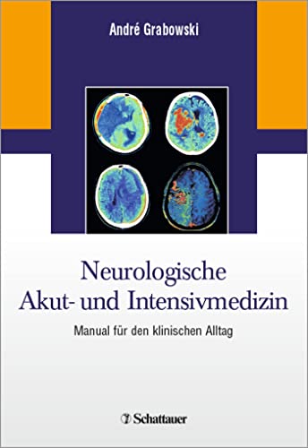 Beispielbild fr Neurologische Akut- und Intensivmedizin: Manual fr den klinischen Alltag zum Verkauf von medimops