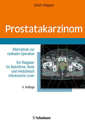 Beispielbild fr Prostatakarzinom: Alternativen zur radikalen Operation Ein Ratgeber fr Betroffene, rzte und medizinisch interessierte Leser zum Verkauf von Antiquariat BuchX