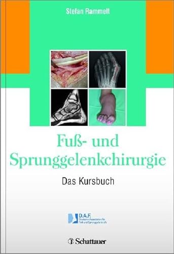 Beispielbild fr Fu- und Sprunggelenkchirurgie: Das Kursbuch zum Verkauf von medimops