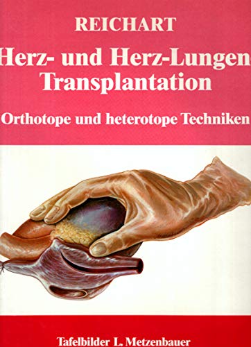 Beispielbild fr Herz- und Herz-Lungen-Transplantation. Orthotope und heterotope Techniken. zum Verkauf von medimops