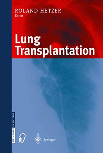 9783798510623: Lung Transplantation