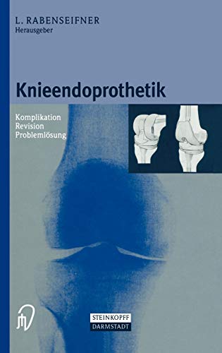 Stock image for Knieendoprothetik. Komplikation - Revision - Problemlsung for sale by medimops