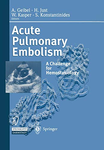 Stock image for Acute Pulmonary Embolism: A Challenge for Hemostasiology for sale by Poverty Hill Books