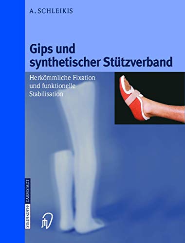 9783798512108: Gips Und Synthetischer Sttzverband: Herkmmliche Fixation Und Funktionelle Stabilisation