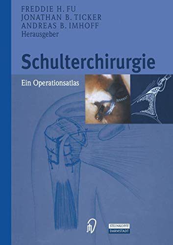 Beispielbild fr Schulterchirurgie. Ein Operationsatlas. [bers.: E. Hohmann u. M. Brosche; Zeichn.: W. R. Filer]. zum Verkauf von Rhein-Hunsrck-Antiquariat Helmut Klein