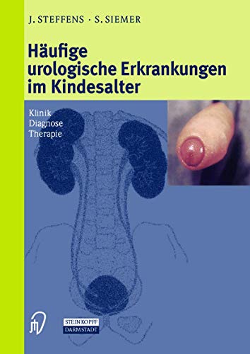 Stock image for Hufige urologische Erkrankungen im Kindesalter for sale by medimops