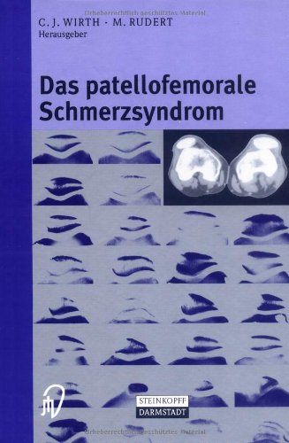 Imagen de archivo de Das patellofemorale Schmerzsyndrom a la venta por medimops