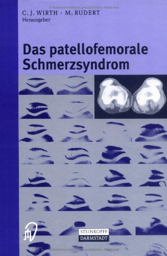 Stock image for Das patellofemorale Schmerzsyndrom for sale by medimops