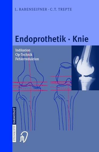 Beispielbild fr Endoprothetik Knie zum Verkauf von Norbert Kretschmann