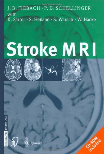 Beispielbild fr Stroke MRI zum Verkauf von Better World Books