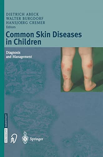9783798513891: Common Skin Diseases in Children: Diagnosis and Management