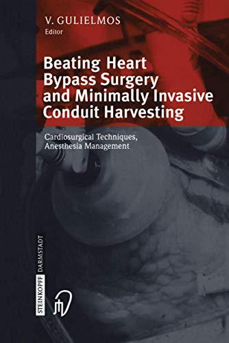 Imagen de archivo de Beating Heart Bypass Surgery and Minimally Invasive Conduit Harvesting: Cardiosurgical Techniques, Anesthesia Management a la venta por medimops