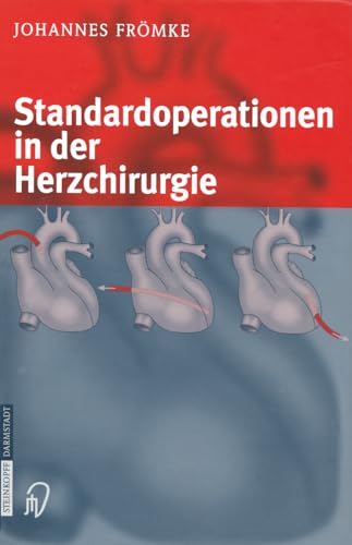 Beispielbild fr Standardoperationen in der Herzchirurgie [Gebundene Ausgabe] von Johannes Frmke (Autor) zum Verkauf von BUCHSERVICE / ANTIQUARIAT Lars Lutzer