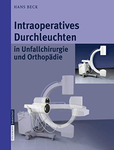 Intraoperatives Durchleuchten in Unfallchirurgie und OrthopÃ¤die (German Edition) (9783798514768) by Beck, Hans