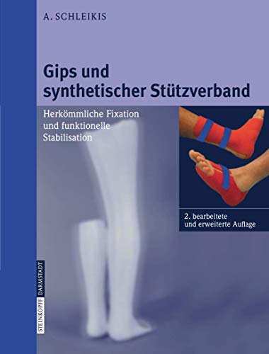 9783798514843: Gips Und Synthetischer Stutzverband: Herkommliche Fixation Und Funktionelle Stabilisation