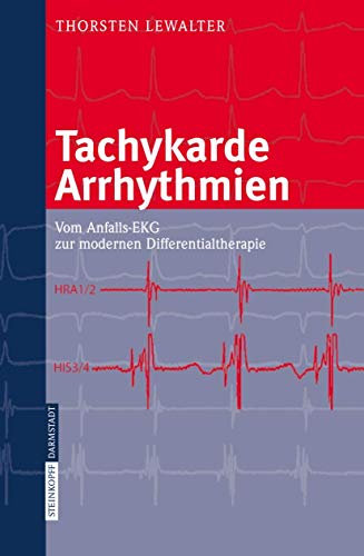 Beispielbild fr Tachykarde Arrhythmien: Vom Anfalls-EKG zur modernen Differentialtherapie zum Verkauf von medimops