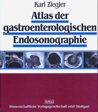 9783804711587: Atlas der gastroenterologischen Endosonographie