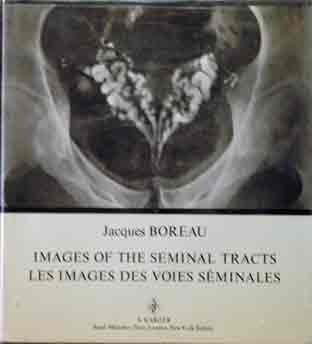 Imagen de archivo de Images of the Seminal Tracts: Radiological and Clinical Comparisons / Les Images des Voies Seminales: Confrontation Radio-Clinique a la venta por Zubal-Books, Since 1961