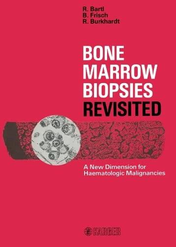 Stock image for Bone Marrow Biopsies Revisited: New Dimension for Haematologic Malignancies for sale by P.C. Schmidt, Bookseller