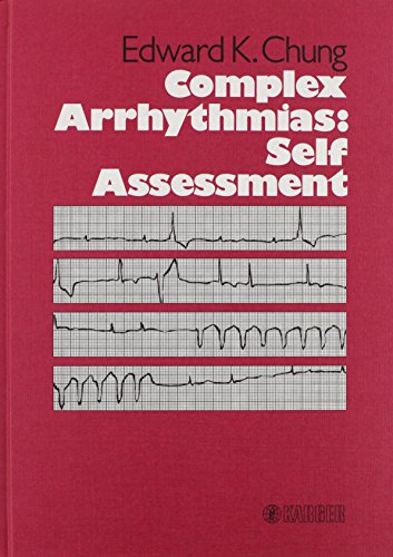 Complex Arrhythmias: Self Assessment (9783805536394) by Chung, E. K.