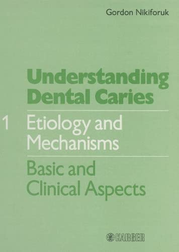 Stock image for Understanding Dental Caries Vol. 1: Etiology & Mechanisms for sale by ThriftBooks-Atlanta