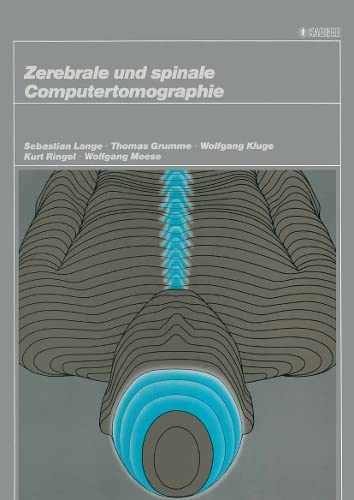 Imagen de archivo de Zerebrale und spinale Computertomographie a la venta por Versandantiquariat Felix Mcke