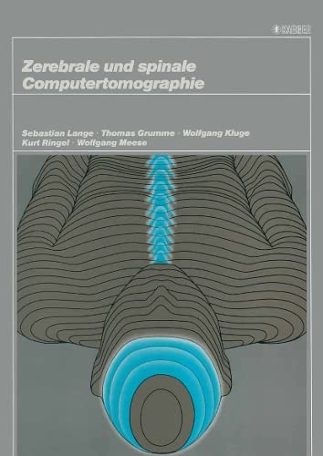 Stock image for Zerebrale und spinale Computertomographie for sale by Versandantiquariat Felix Mcke
