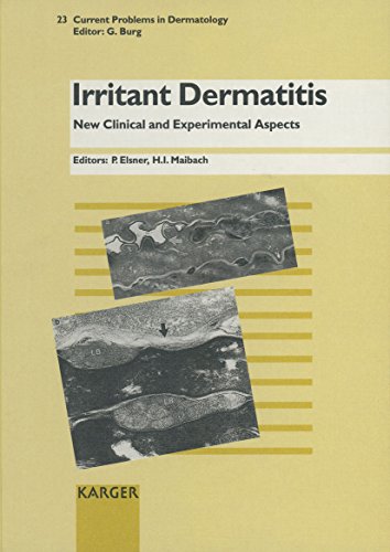 Beispielbild fr Irritant Dermatitis: New Clinical and Experimental Aspects zum Verkauf von P.C. Schmidt, Bookseller