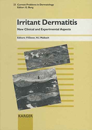 Imagen de archivo de Irritant Dermatitis: New Clinical and Experimental Aspects a la venta por P.C. Schmidt, Bookseller