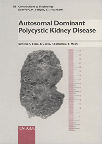 Beispielbild fr Autosomal Dominant Polycystic Kidney Desease: Seminar on Autosomal Dominant Polycystic Kidney Disease, Vimercate, June 18, 1994 zum Verkauf von Ammareal