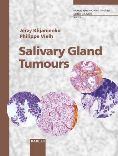 Imagen de archivo de Salivary Gland Tumours: Monographs in Clinical Cytology a la venta por Solr Books