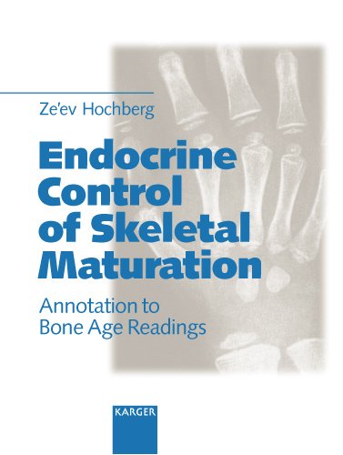 Imagen de archivo de Endocrine Control of Skeletal Maturation: Annotation to Bone Age Readings a la venta por HPB-Red