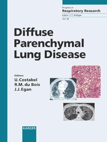 Stock image for Diffuse Parenchymal Lung Disease for sale by ThriftBooks-Atlanta