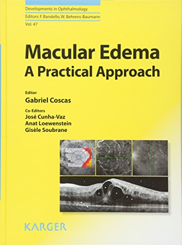 Imagen de archivo de Macular Edema: A Practical Approach (Developments in Ophthalmology) a la venta por Allyouneedisbooks Ltd