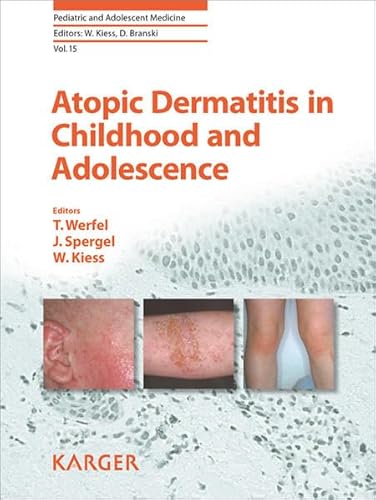 Stock image for Atopic Dermatitis In Childhood And Adolescence for sale by Basi6 International