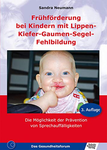 Stock image for Frhfrderung bei Kindern mit Lippen-Kiefer-Gaumen-Segel-Fehlbildung for sale by medimops