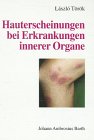 Stock image for Hauterscheinungen bei Erkrankungen innerer Organe Dermatosen Dickdarmpolypose perianale Hyperpigmentierung Blickdiagnose Haut Innere Medizin Dermatologie Hautarzt Dermatologe Lyme-Borreliose Frherkennung Malignome Morbus Crohn Makromorphologie Laszlo Trk (Autor) bersetzer Laszlo Trk (Autor) bersetzer em. Prof. Dr. med. Sndor Marghescu Sandor Marghescu for sale by BUCHSERVICE / ANTIQUARIAT Lars Lutzer