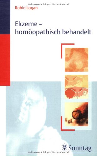 Beispielbild fr Ekzeme - homopathisch behandelt. zum Verkauf von Wissenschaftliches Antiquariat Kln Dr. Sebastian Peters UG