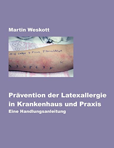 9783831137329: Prvention der Latexallergie in Krankenhaus und Praxis: Eine Handlungsanleitung (German Edition)
