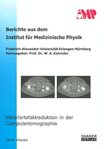 9783832200336: Watzke, O: Metallartefaktreduktion in der Computertomographi