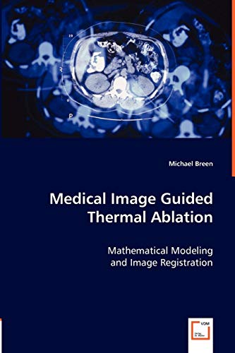 Stock image for Medical Image Guided Thermal Ablation: Mathematical Modeling and Image Registration for sale by Lucky's Textbooks