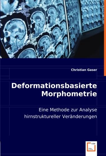 Stock image for Deformationsbasierte Morphometrie: Eine Methode Zur Analyse Hirnstruktureller Vernderungen for sale by Revaluation Books