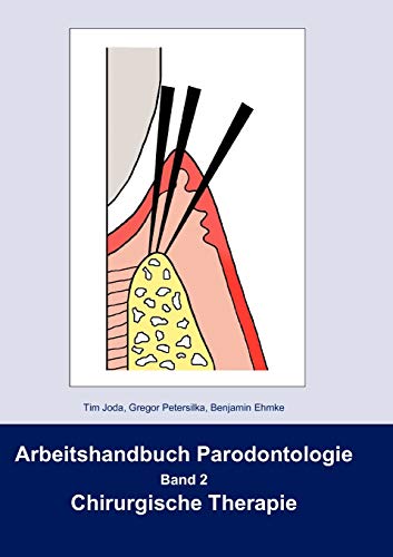 Stock image for Arbeitshandbuch Parodontologie:Band 2 Chirurgische Therapie for sale by Blackwell's