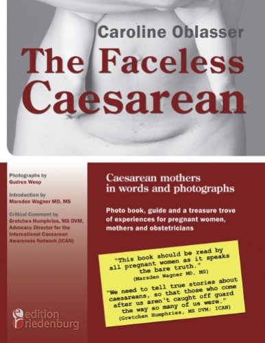 9783837075601: The Faceless Caesarean - Caesarean mothers in words and photographs. Photo book, guide and a treasure trove of experiences for pregnant women, mothers and obstetricians