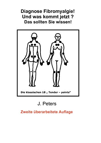 Beispielbild fr Diagnose Fibromyalgie! Und was kommt jetzt?:Das sollten sie Wissen! zum Verkauf von Chiron Media