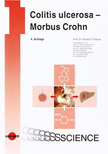 Beispielbild fr Colitis ulcerosa - Morbus Crohn zum Verkauf von Versandantiquariat Felix Mcke
