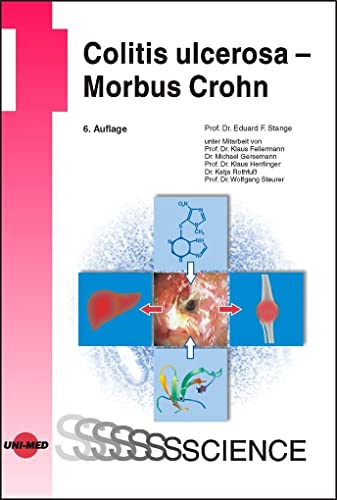 Stock image for Colitis ulcerosa - Morbus Crohn for sale by GF Books, Inc.