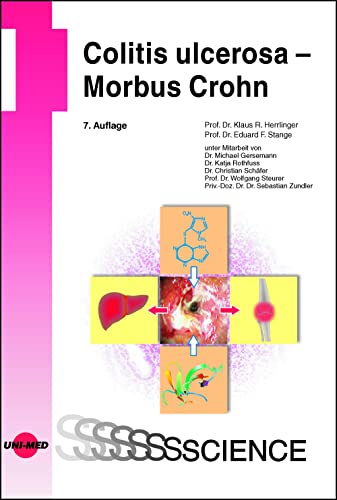 Stock image for Colitis ulcerosa - Morbus Crohn for sale by Revaluation Books