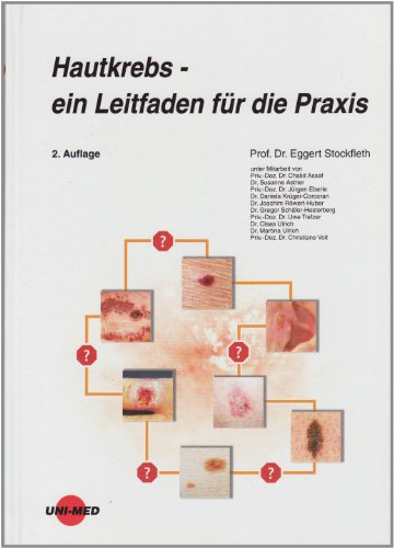 Beispielbild fr Hautkrebs - ein Leitfaden fr die Praxis. 2. Aufl. zum Verkauf von Antiquariat + Buchhandlung Bcher-Quell